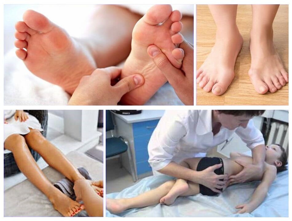 Deformazione di Valgus nel trattamento dei bambini