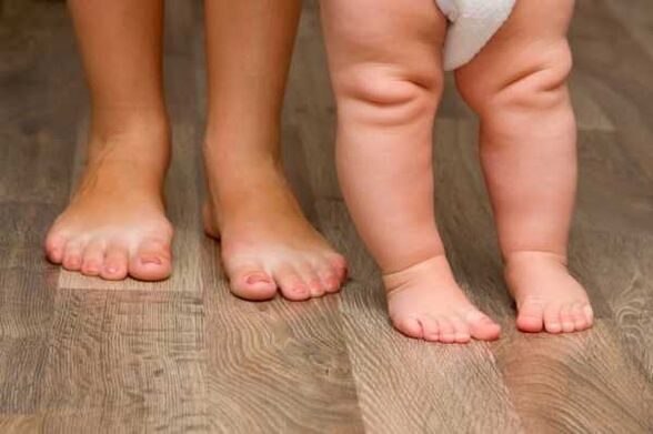 Valgus Deformation nei bambini