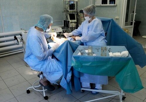 Operazione